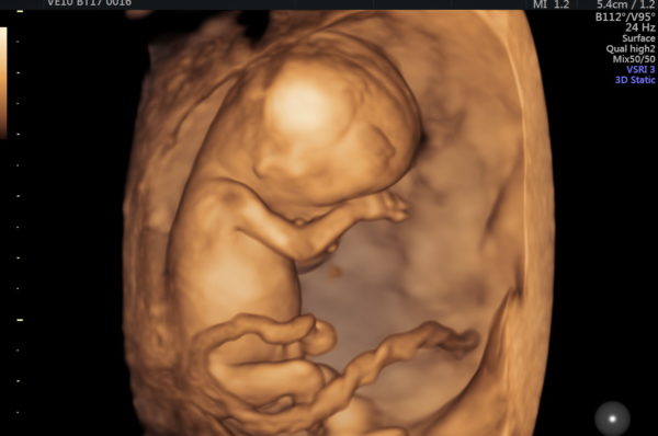foto sito primo trimestre
